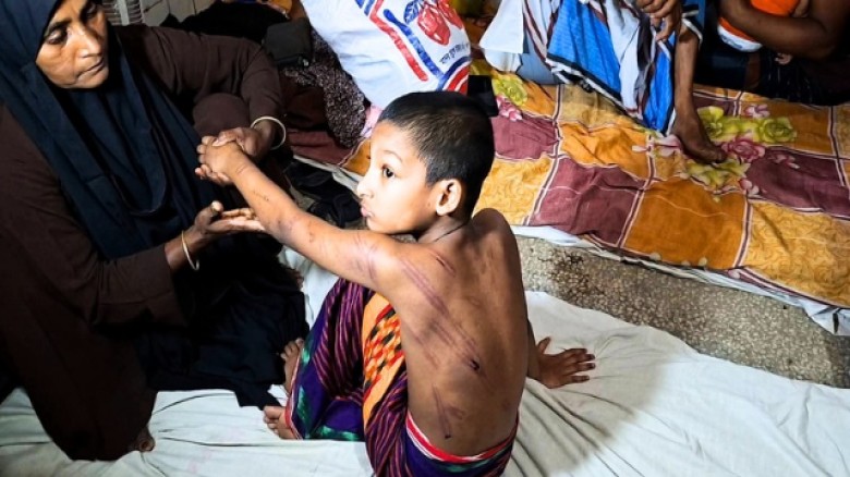 সামান্য কারণে বেত্রাঘাত, মাদরাসায় শিশুর শরীরজুড়ে ক্ষতচিহ্ন